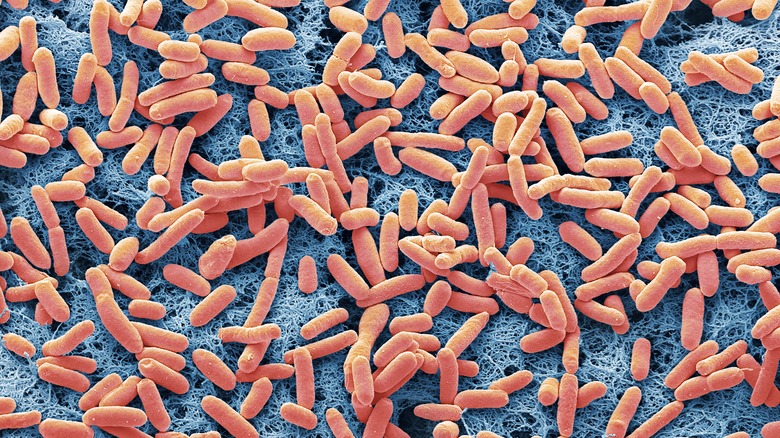 microscope image of e. coli bacteria